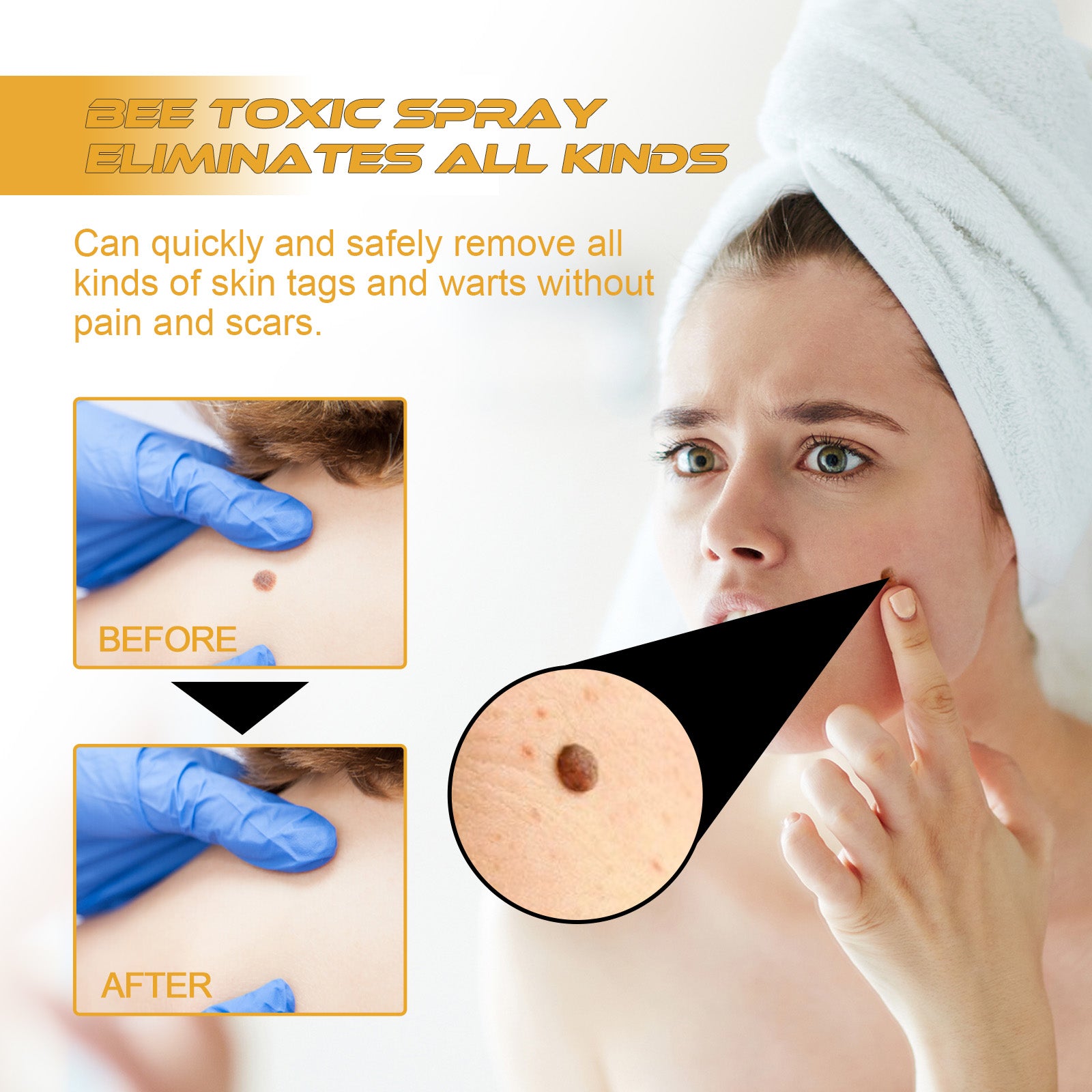 XIMONTH Bee Venom Care Spray