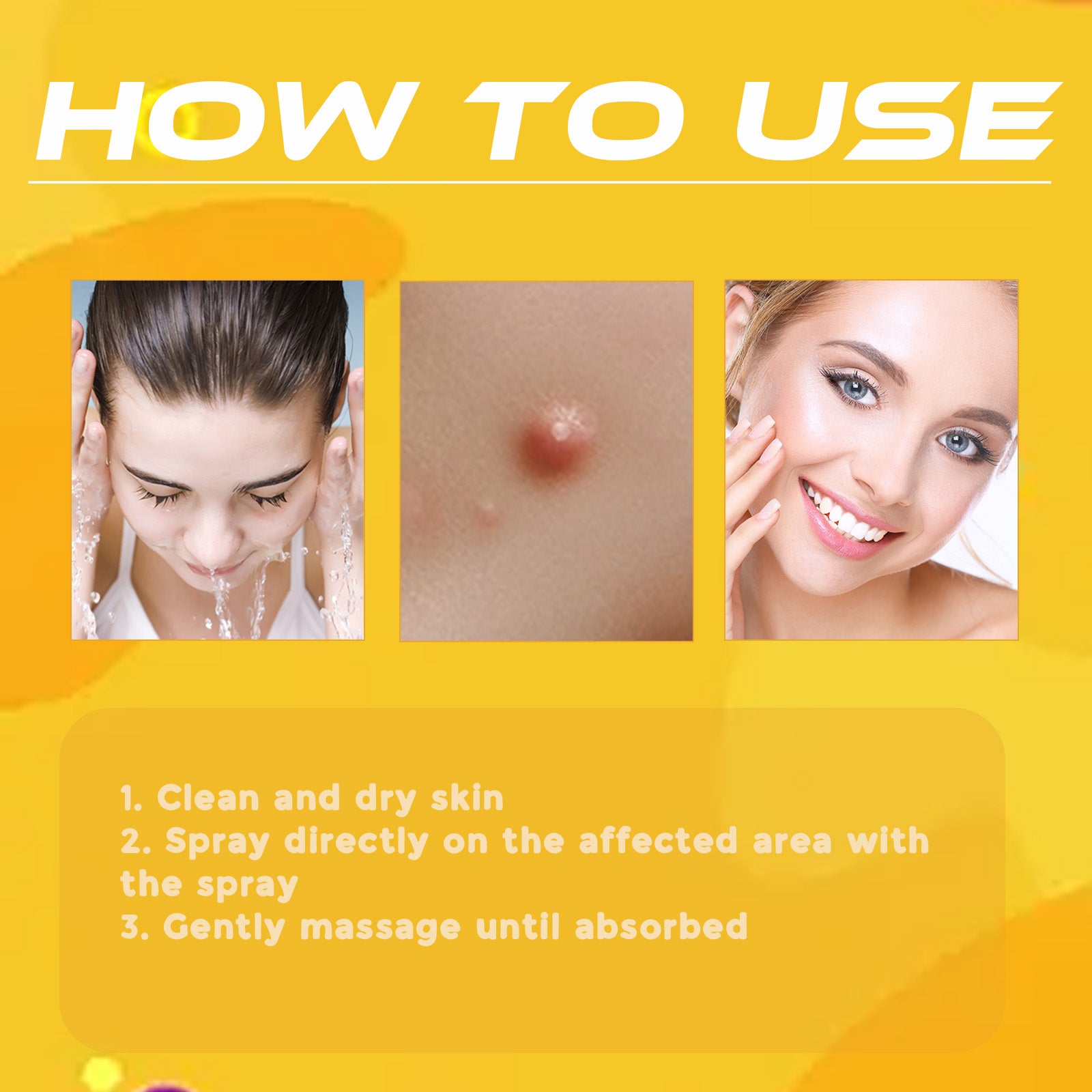 XIMONTH Bee Venom Care Spray